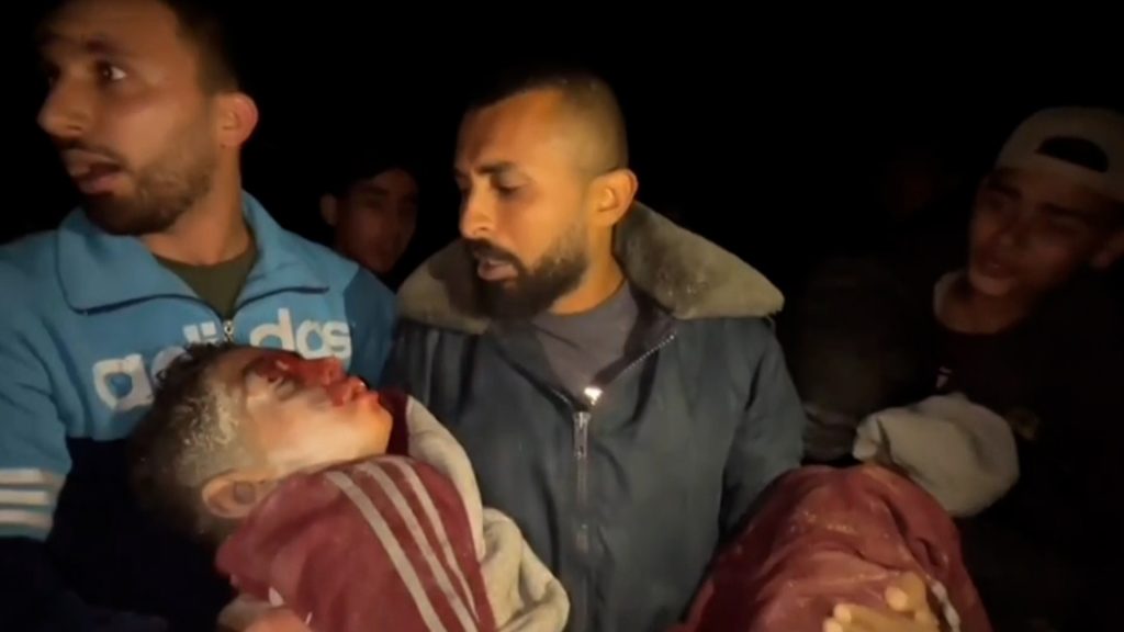 منظمة الصحة العالمية: اليأس يتزايد في مستشفيات غزة في ظل جوع حاد