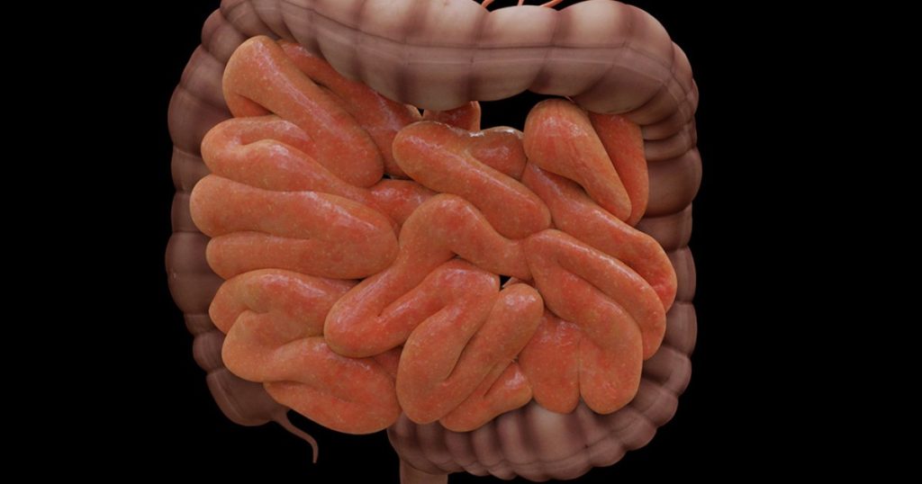 ما متلازمة تخمر الأمعاء؟