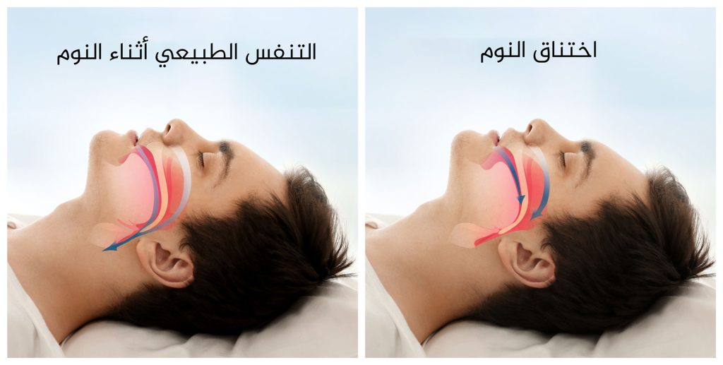 نومك أقل من 7 ساعات يوميا يهددك بهذا المرض الخطير