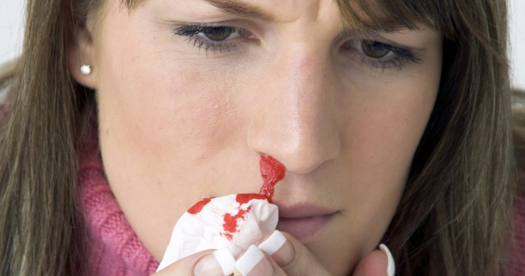 ما هي متلازمة “فون ويلبراند”؟