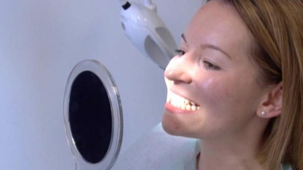 خطوة مهمة قبل تبييض الأسنان