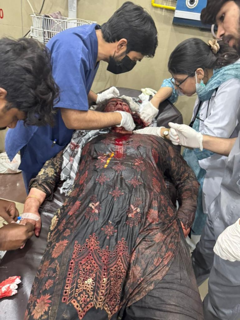 epa12078850 A handout photo made available by the Pakistani military Inter Services Public Relations, shows a person being treated after suffering injuries during a suspected Indian missile attack, at a hospital in Bahawalpur, Pakistan, 07 May 2025. India said it conducted military strikes on nine sites in Pakistan in retaliation for a deadly militant attack on tourists in Kashmir. EPA-EFE/ISPR / HANDOUT HANDOUT EDITORIAL USE ONLY/NO SALES