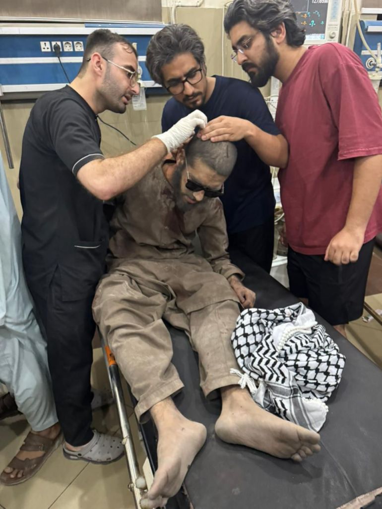 epa12078851 A handout photo made available by the Pakistani military Inter Services Public Relations, shows a person being treated after suffering injuries during a suspected Indian missile attack, at a hospital in Bahawalpur, Pakistan, 07 May 2025. India said it conducted military strikes on nine sites in Pakistan in retaliation for a deadly militant attack on tourists in Kashmir. EPA-EFE/ISPR / HANDOUT HANDOUT EDITORIAL USE ONLY/NO SALES