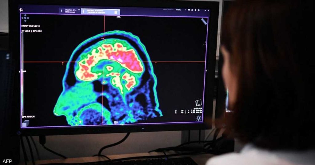 كيف تتذكر الأشياء التي تنساها عادة؟.. إليك الطريقة