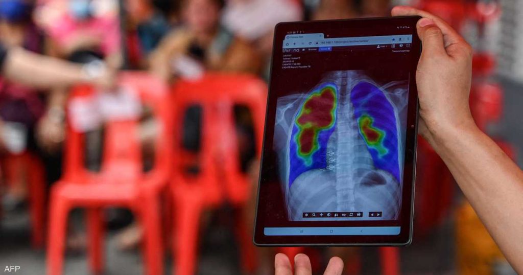 الصحة العالمية: وفاة أكثر من مليون شخص بهذا المرض